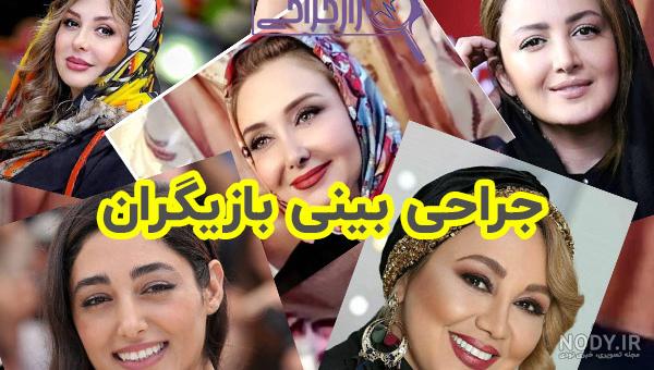 عکس و فیلم) عمل مجدد بینی نیوشا ضیغمی و درگیری با شیلا خداداد! عکس و فیلم) عمل مجدد بینی نیوشا ضیغمی و درگیری با شیلا خداداد!