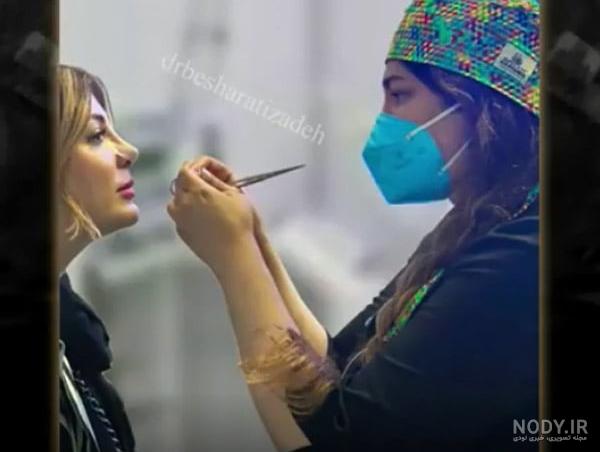 عکس قبل و بعد از عمل بینی افراد مشهور را ببینید - عمل زیبایی بازیگران زن ایرانی - مجله تصویر زندگی عکس قبل و بعد از عمل بینی افراد مشهور را ببینید - عمل زیبایی بازیگران زن ایرانی - مجله تصویر زندگی
