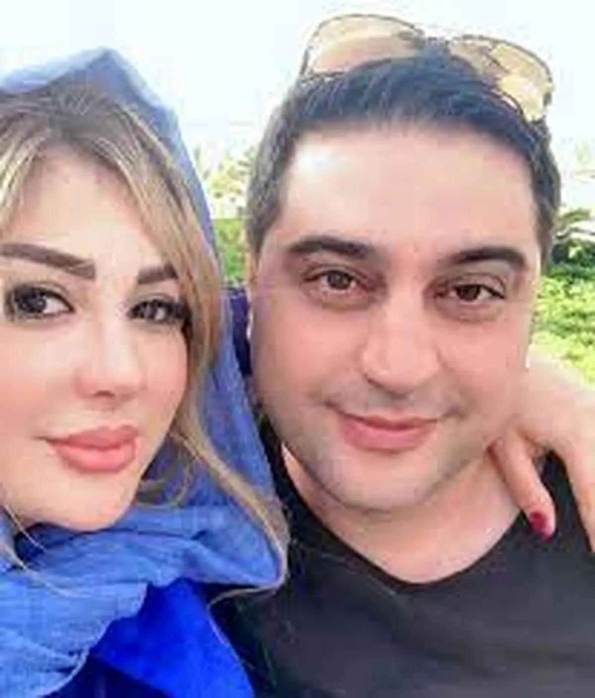 عکس قبل و بعد عمل بینی نیوشا ضیغمی عکس قبل و بعد عمل بینی نیوشا ضیغمی