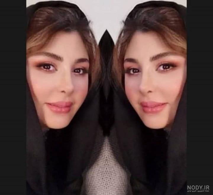 عکس نیوشا ضیغمی قبل از عمل بینی ❤️ [ بهترین تصاویر ]