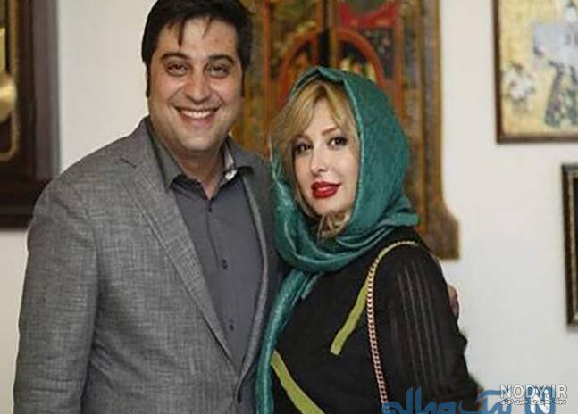 قبل و بعد عمل نیوشا ضیغمی | رویینو قبل و بعد عمل نیوشا ضیغمی | رویینو