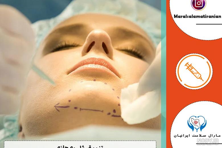 قبل و بعد چانه - دانستنی های پزشکی زیبایی آوان قبل و بعد چانه - دانستنی های پزشکی زیبایی آوان