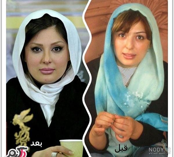 نیوشا ضیغمی از بینی جدیدش رونمایی کرد + عکس دیده نشده نیوشا ضیغمی از بینی جدیدش رونمایی کرد + عکس دیده نشده