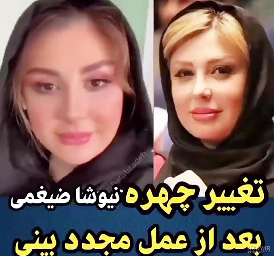 نیوشا ضیغمی قبل و بعد از عمل زیبایی/ تصاویر نیوشا ضیغمی قبل و بعد از عمل زیبایی/ تصاویر