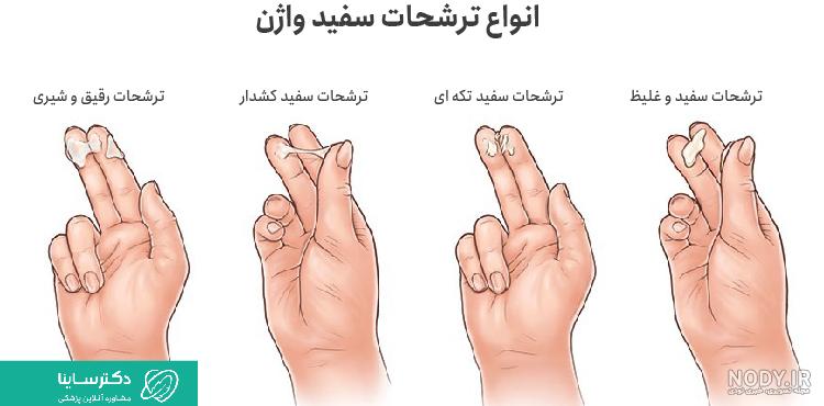 علائم بارداری بعد از ۴۸ ساعت سکس+ترشح سفید قبل از پریود نشانه بارداری است
