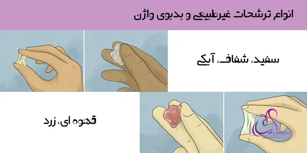 علائم بارداری بعد از ۴۸ ساعت سکس+ترشح سفید قبل از پریود نشانه بارداری است