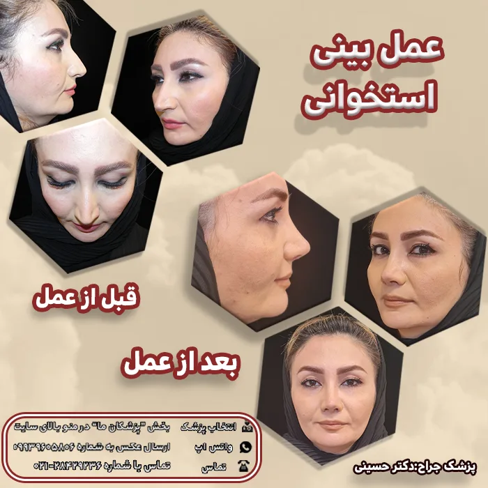 تصاویر قبل و بعد از آرایش - مجله نورگرام تصاویر قبل و بعد از آرایش - مجله نورگرام