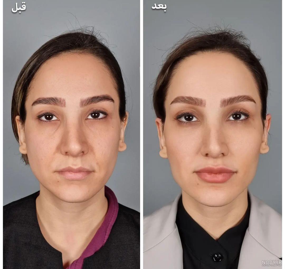 عکس قبل و بعد آرایش
