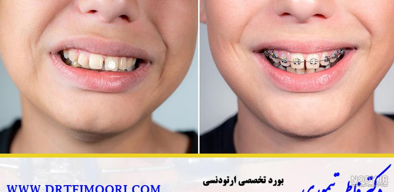 طنز فاطی تیموری/مقایسه دعوای من و دعوای دیگران