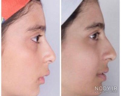 عکس فاطمه تیموری تیک تاکر - عکس نودی