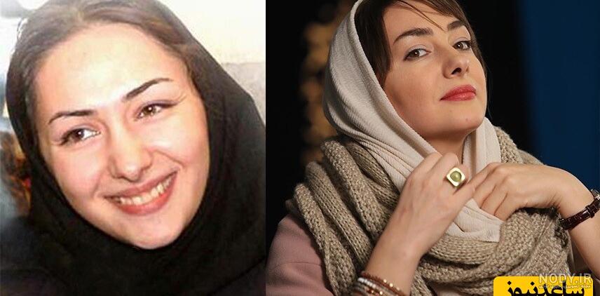 احسان علیخانی بعد مدت‌ها با چهره شکسته پیدایش شد