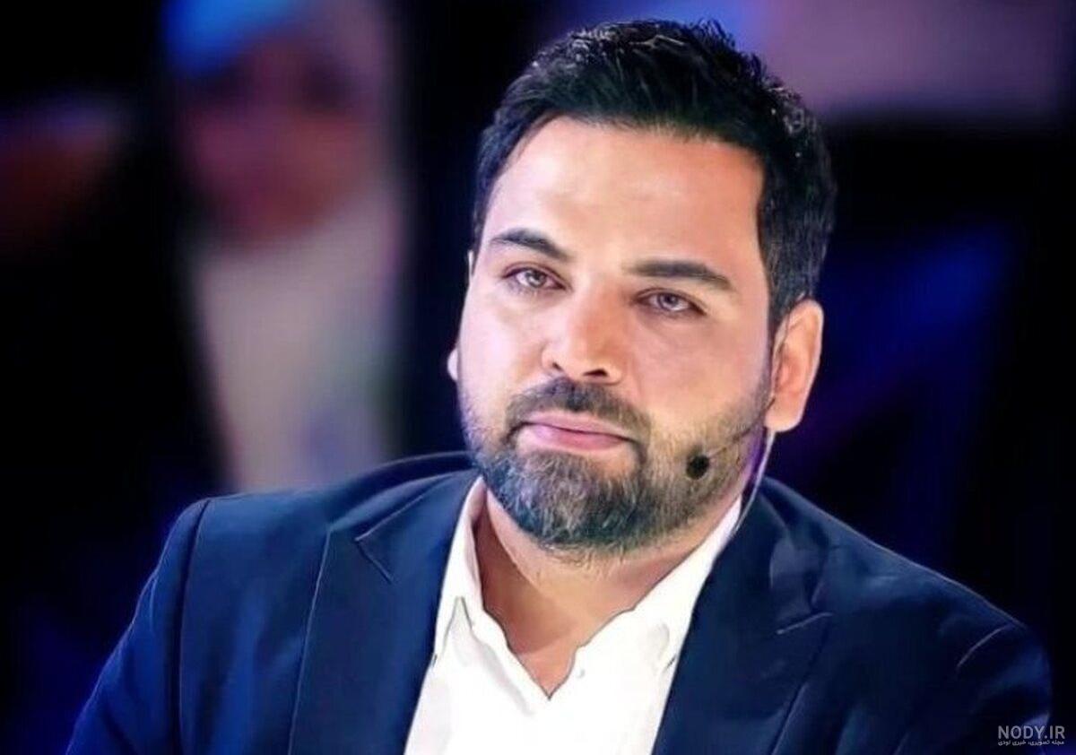تصاویر احسان علیخانی قبل و بعد از عملش تصاویر احسان علیخانی قبل و بعد از عملش