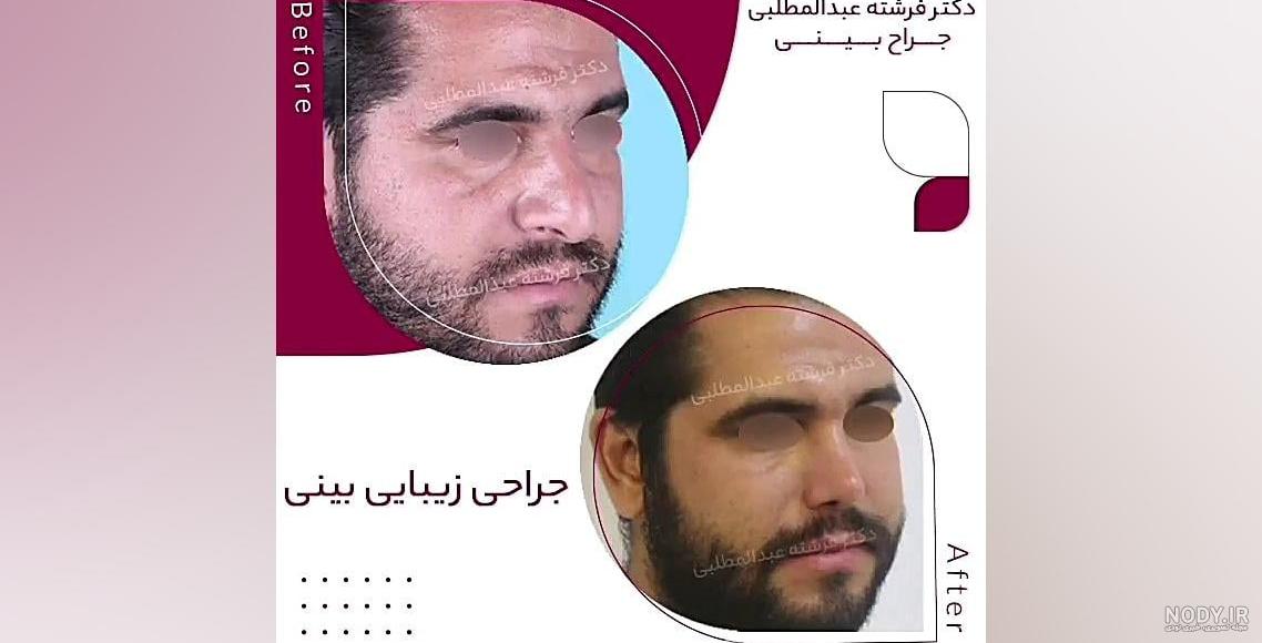 رونمایی از تصاویر قبل عمل زیبایی بازیگران زن ایرانی/ از شیلا خداداد تا نیوشا ضیغمی+ رونمایی از تصاویر قبل عمل زیبایی بازیگران زن ایرانی/ از شیلا خداداد تا نیوشا ضیغمی+