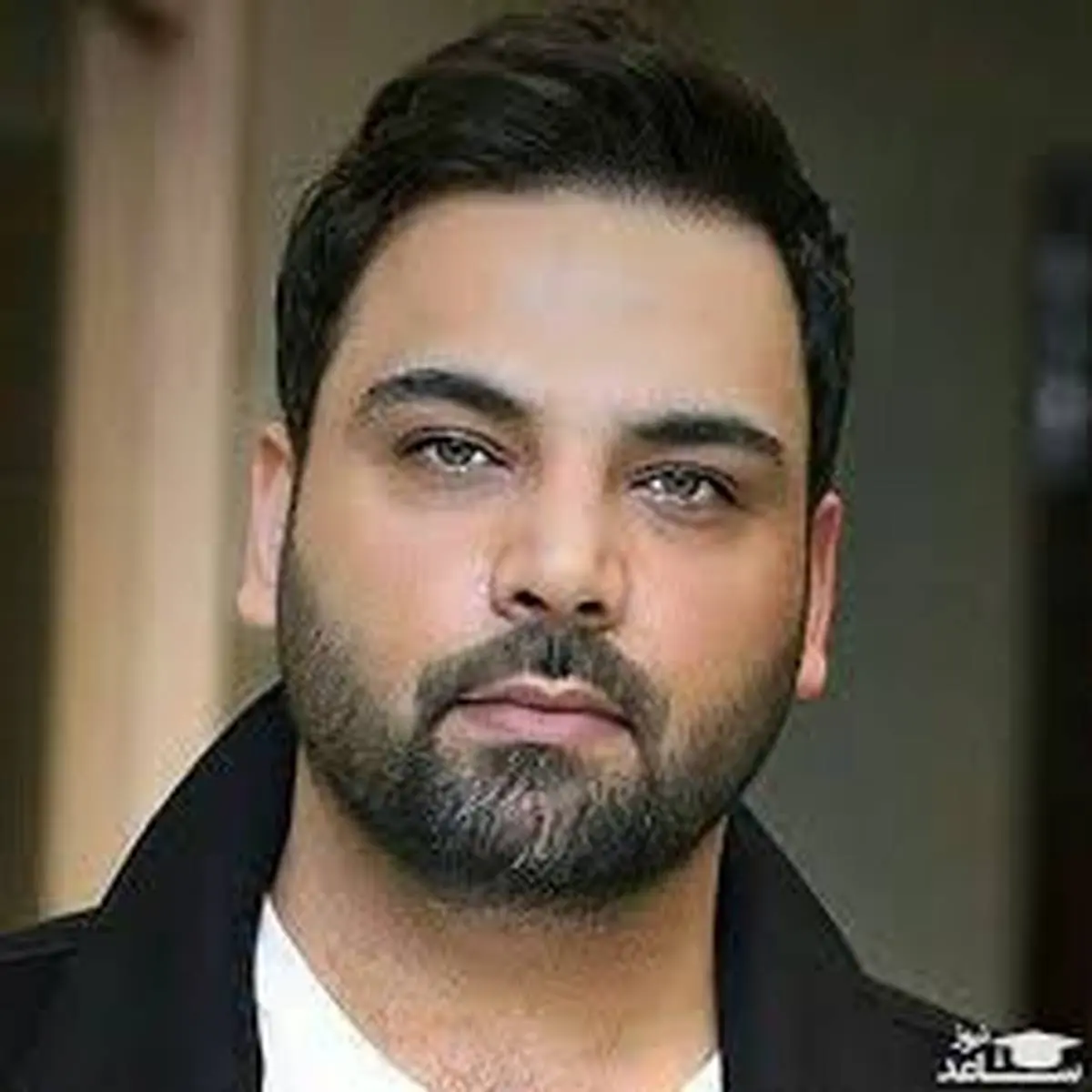 عکس احسان علیخانی قبل عمل بینی