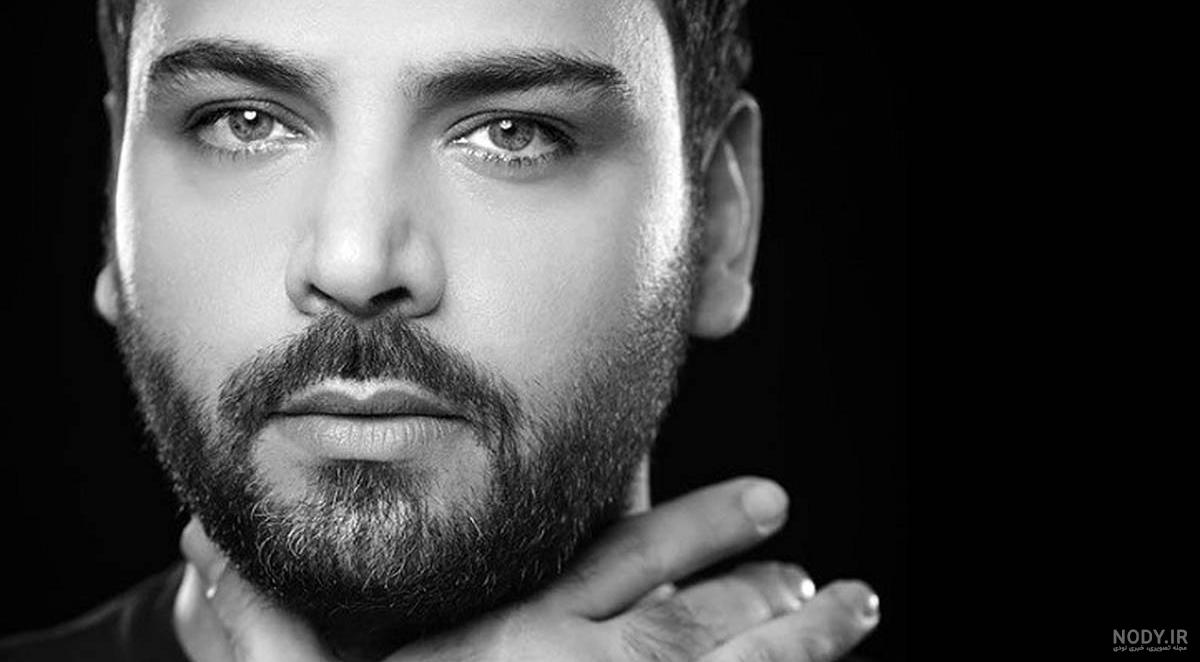 عکس قبل و بعد عمل بینی احسان علیخانی - دکتر محمد صوفی زاده عکس قبل و بعد عمل بینی احسان علیخانی - دکتر محمد صوفی زاده