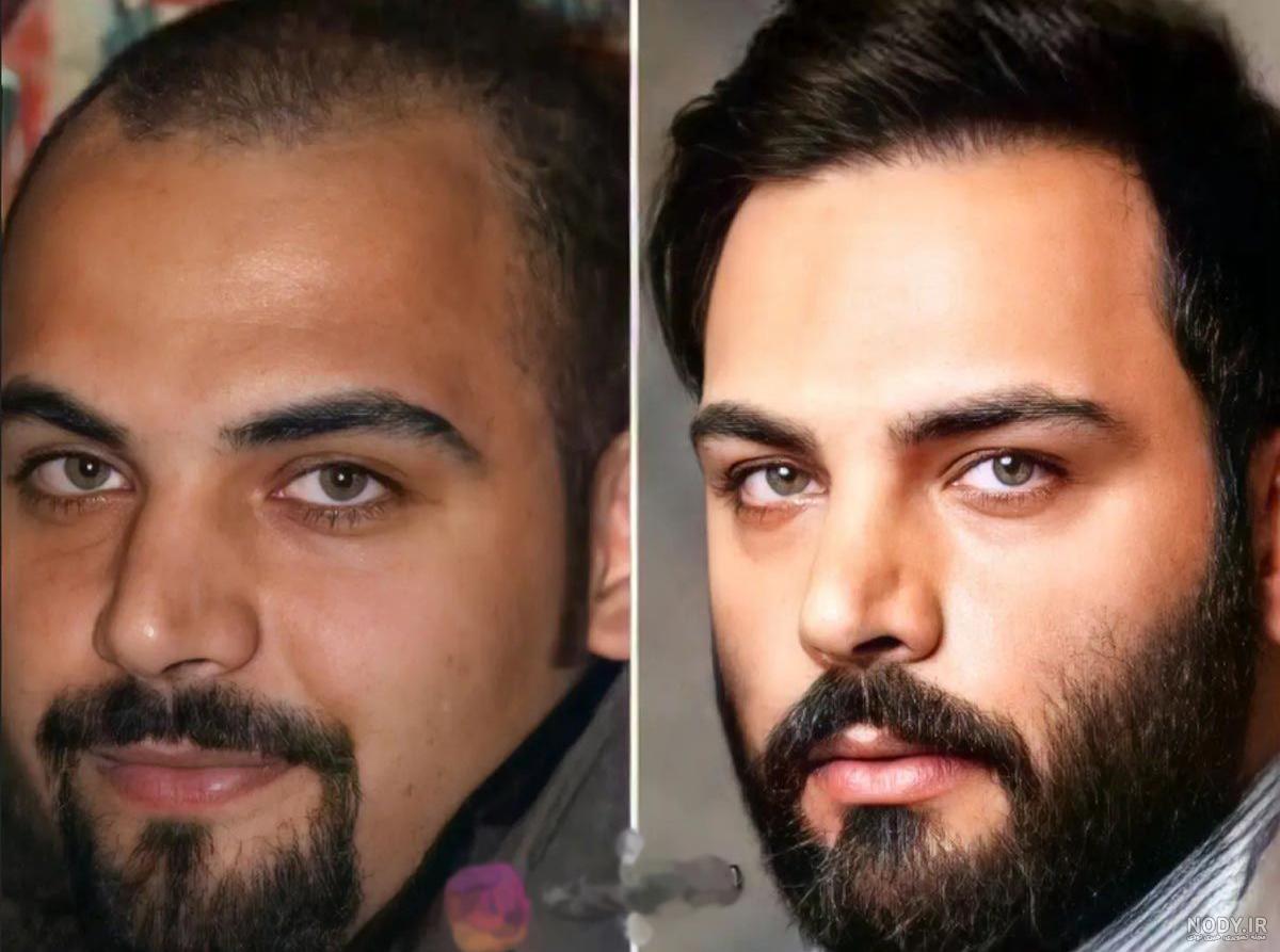 پربازدید شدن عکس چهره خونسرد و خندان احسان علیخانی درحال اهدای خون در بیمارستان/ باعث افتخاری پربازدید شدن عکس چهره خونسرد و خندان احسان علیخانی درحال اهدای خون در بیمارستان/ باعث افتخاری