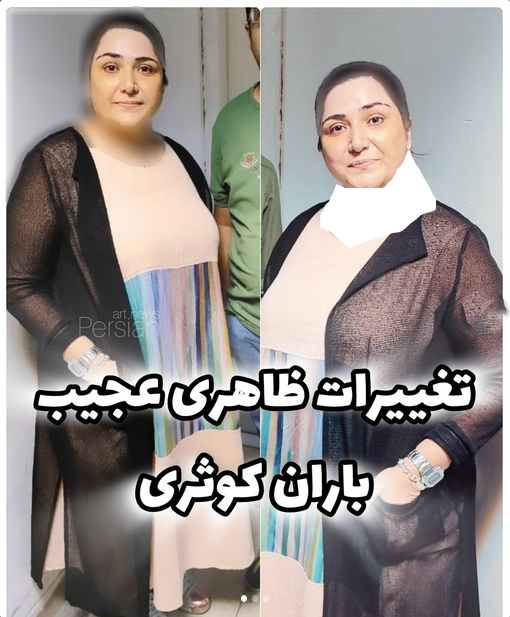 بیوگرافی باران خواننده + عکس های جدید اینستاگرام و عروسی - ویدائو مگ