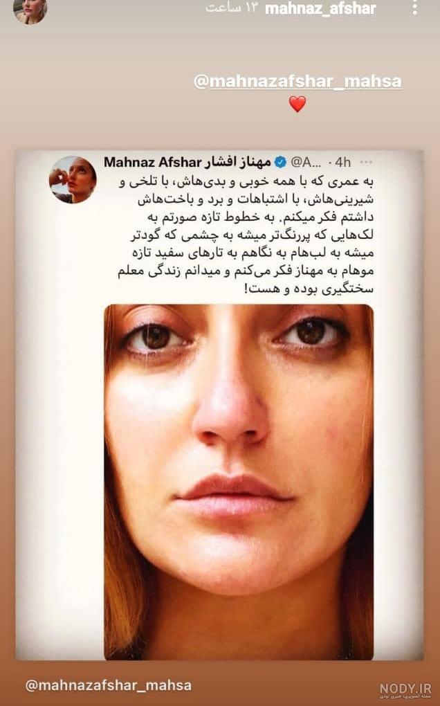 مهناز افشار وقتی سبیل داشت / عکس · جدید ۱۴۰۳ -❤️ گهر