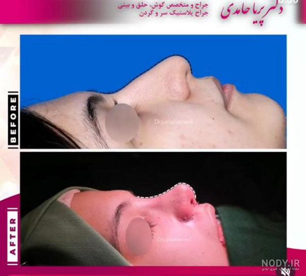 عکس های عروسی پریا حامدی عکس های عروسی پریا حامدی