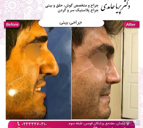 عکس پریا حامدی - عکس نودی عکس پریا حامدی - عکس نودی