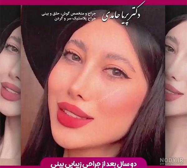 عکس های پریا حامدی و همسرش عکس های پریا حامدی و همسرش