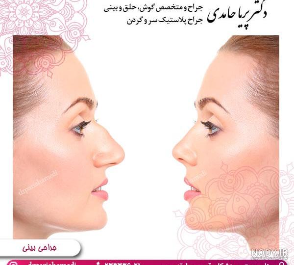 پریا حامدی پریا حامدی