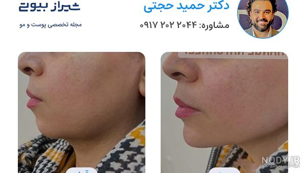 دانلود آهنگ دکتر حمید سو تفاهم