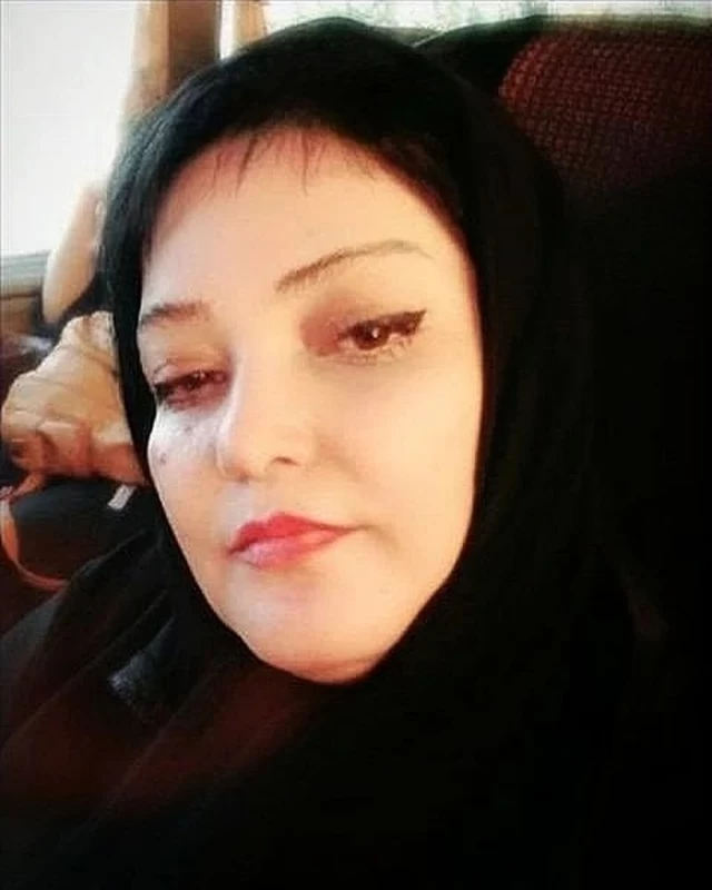 عکس) حسین رضازاده غیرقابل شناسایی شد