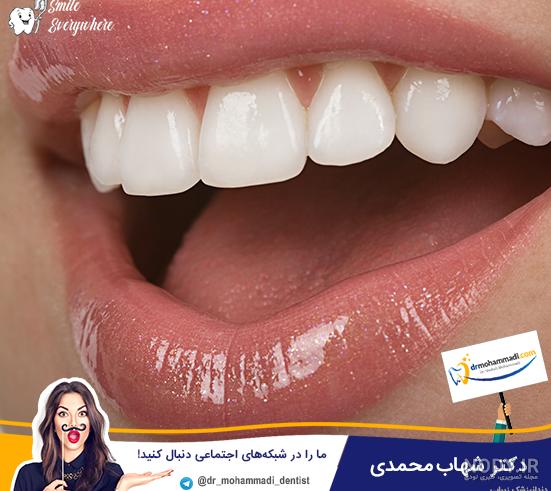 15 نسخه سفیدی دندان با جوش شیرین + نکات و هشدارها