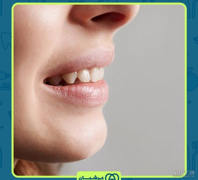 آیا سفید کردن دندان با روغن نارگیل واقعیت دارد؟ - دکتر کامیار خضری