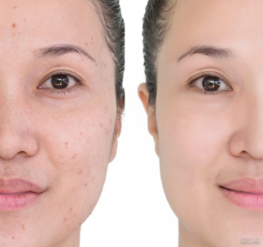 ترکیب سرکه و جوش‌شیرین پاک‌کننده‌ای قوی و بی‌خطر - ایسنا