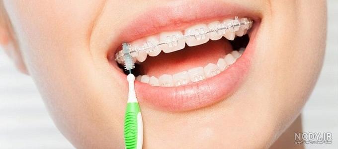 جوش شیرین برای سفید کردن دندان خوبه؟ - فروشگاه خلاق شاپ
