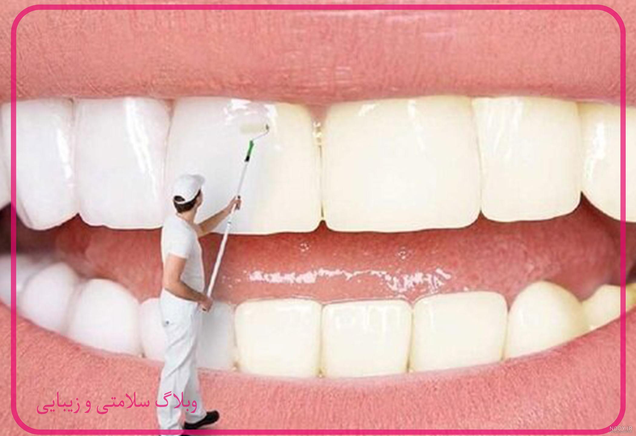جوش شیرین و سلامت دندان - دکتر نسیم اثناعشری متخصص ارتودنسی و مشکلات فک  اصفهان