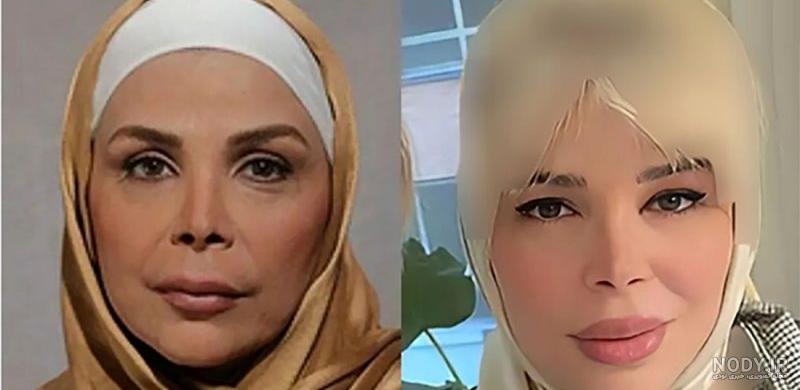 شیوا خنیاگر عکس همسر سابقش را منتشر کرد! | ساتین ⭐️
