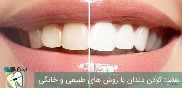 چگونه با جوش شیرین دندان هایمان را سفید کنیم؟