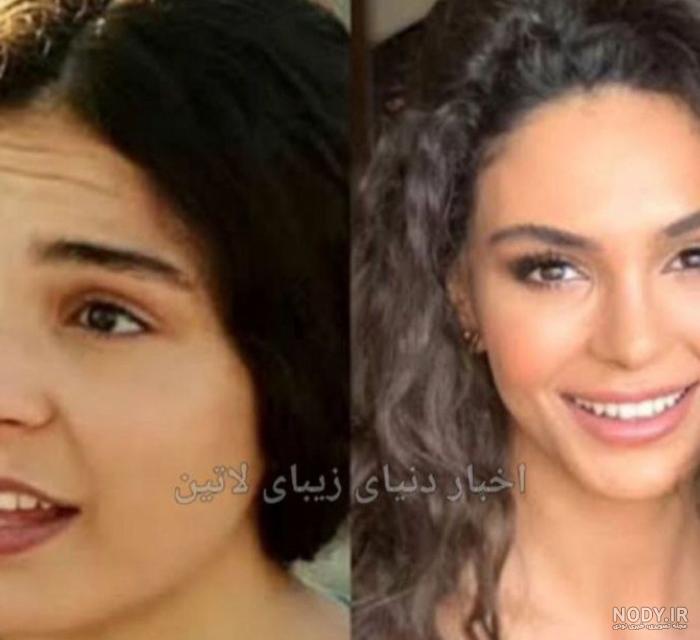 جنجال بر سر اینکه آیا ابرو شاهین عمل زیبایی کرده است یا نه! جنجال بر سر اینکه آیا ابرو شاهین عمل زیبایی کرده است یا نه!