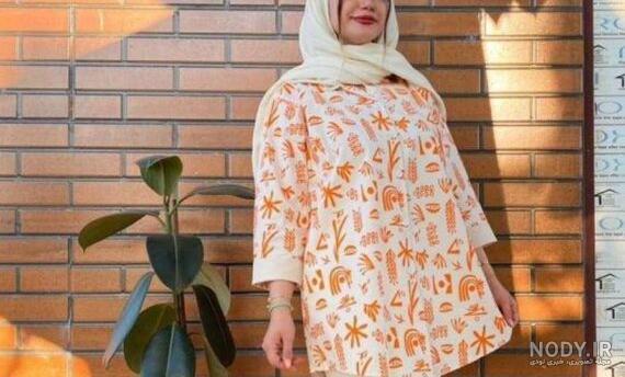 جدیدترین مدل‌های مانتو لنین | با لینن تابستان خنک بپوشید! - ستاره