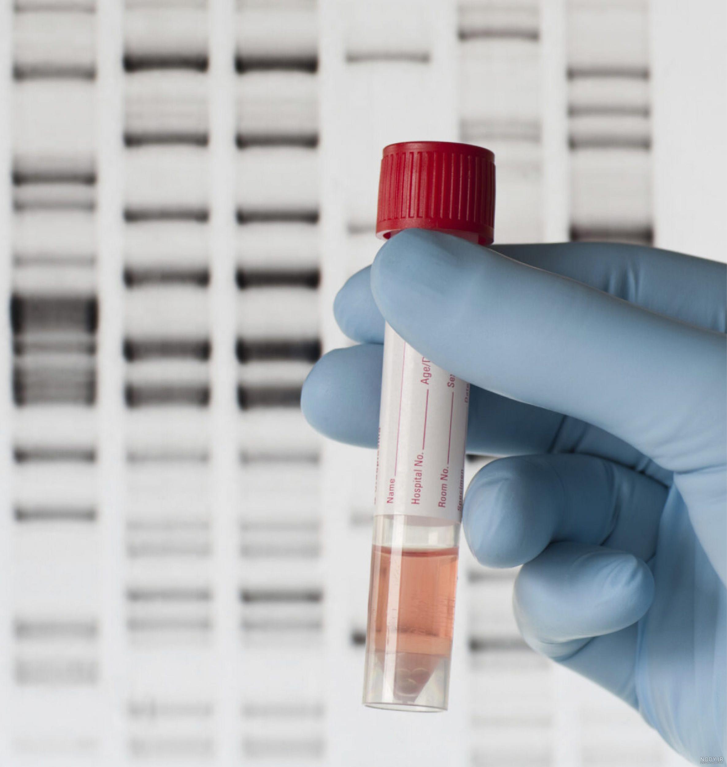 مولکول DNA چیست؟ — از صفر تا صد – فرادرس - مجله‌