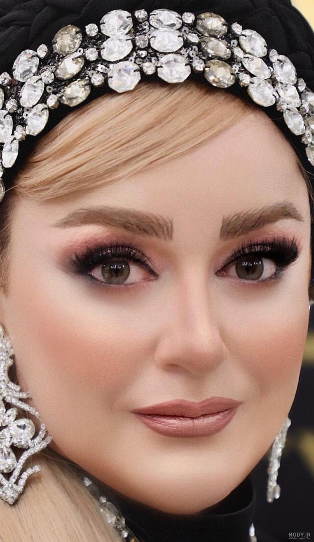 چرا نعیمه نظام‌دوست بعد از عمل لاغری چاق شد؟ +‌عکس قبل و بعد از عمل