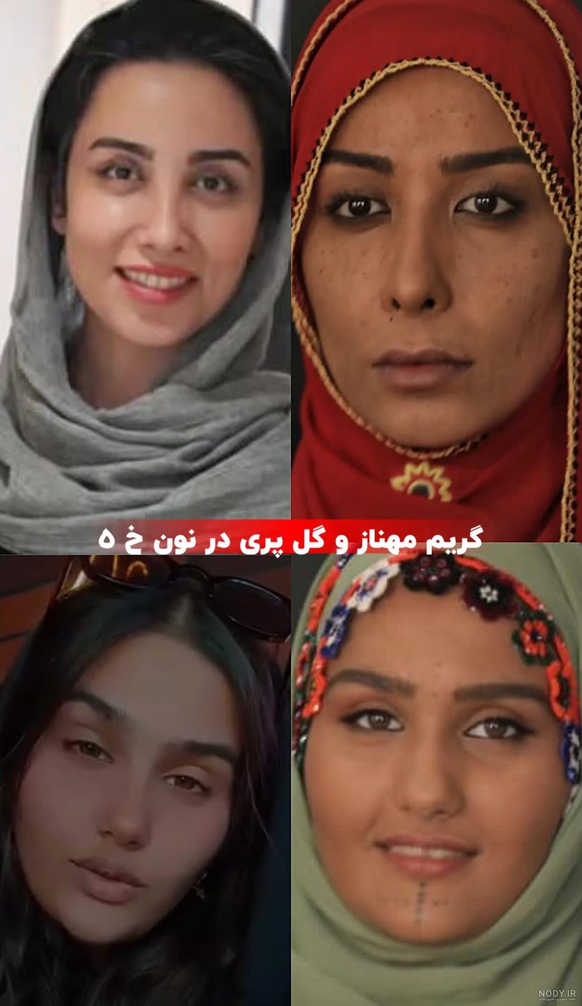 تغییرات چهره بازیگران سریال نون خ + عکس ها نشون میده از سال 98 تا حالا،  آدمای دیگه ای شدن!