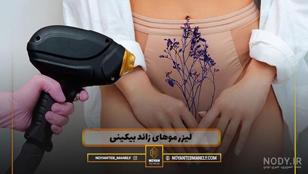 اپیلاسیون با موم خوبه؟ مزایا و معایب اپیلاسیون – آموزش آرایشگری – آموزش  آرایشگری زنانه فنی حرفه ای تهران