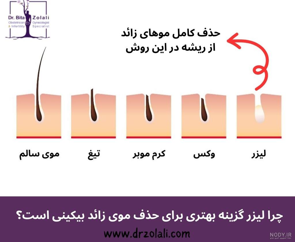 عکس اپیلاسیون - عکس نودی