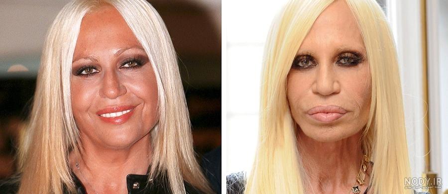 برند ورساچه طلا: از تاریخچه باشکوه تا شکوه انواع مدل‌های بی‌نظیر طلا و جواهر