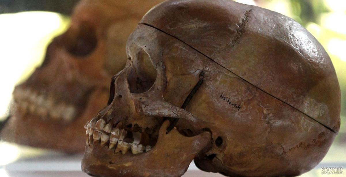 عکس اسکلت مرده - عکس نودی عکس اسکلت مرده - عکس نودی