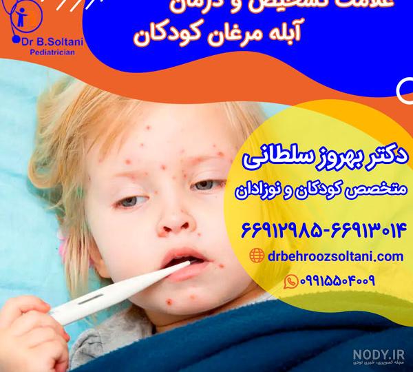 آبله مرغان چیست؟مدت واگیر، علائم+درمان ابله مرغون -دکترمایکو آبله مرغان چیست؟مدت واگیر، علائم+درمان ابله مرغون -دکترمایکو