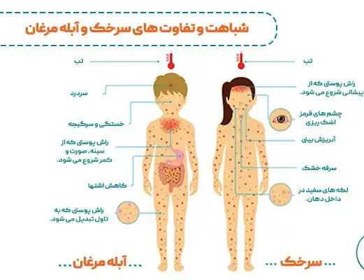 آبله مرغان در کودکان: علائم، روش‌های انتقال و درمان+ عکس- دکترنکست
