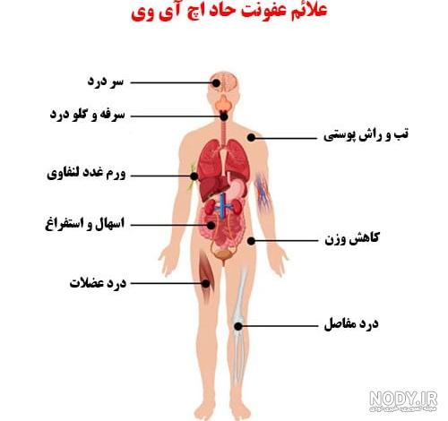 اچ‌آی‌وی - ویکی‌پدیا، دانشنامهٔ آزاد