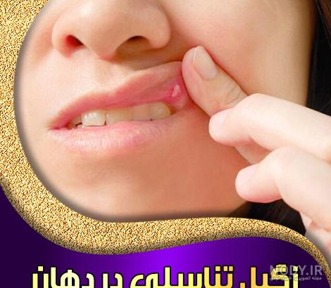 تفاوت آفت با زگیل دهان چیست؟ (بررسی ساده و مقایسه ای هر دو مشکل) | ویکی دندان تفاوت آفت با زگیل دهان چیست؟ (بررسی ساده و مقایسه ای هر دو مشکل) | ویکی دندان