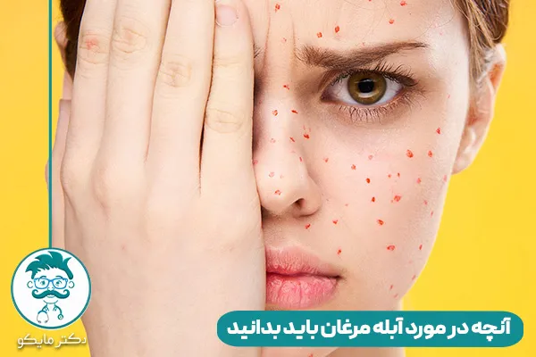 درمان آبله در طیور + روش های انتقال، علائم و پیشگیری - فروشگاه چیکن دیوایس درمان آبله در طیور + روش های انتقال، علائم و پیشگیری - فروشگاه چیکن دیوایس