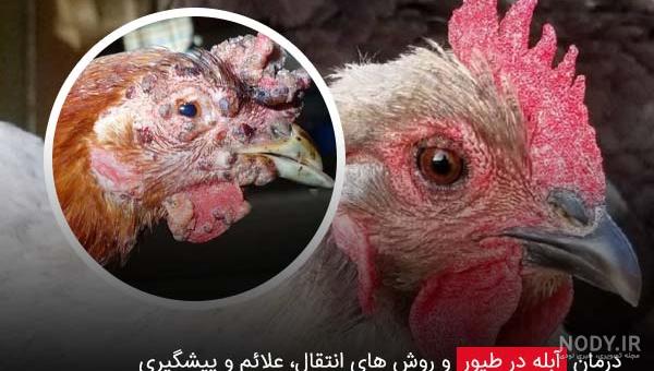 راه های درمان آبله مرغون در کودکان + تشخیص و عکس آبله مرغان کودکان - کلینیک کودکان آنا راه های درمان آبله مرغون در کودکان + تشخیص و عکس آبله مرغان کودکان - کلینیک کودکان آنا